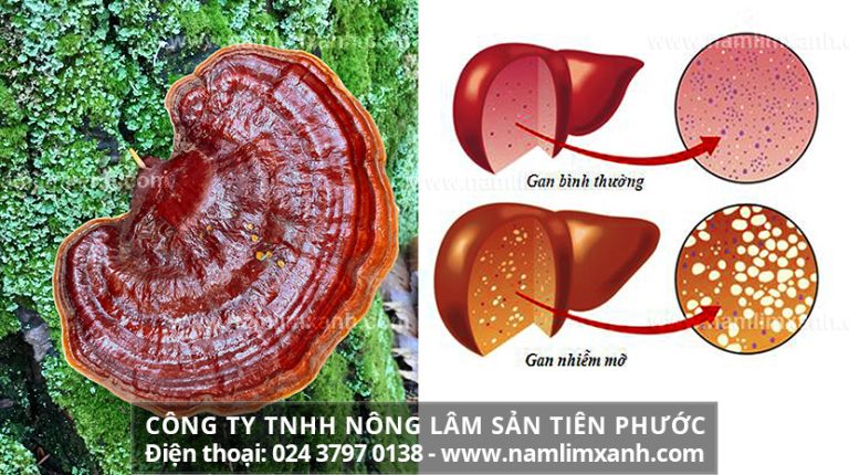 Tác dụng của cây nấm lim xanh hỗ trợ giúp hết bệnh gan